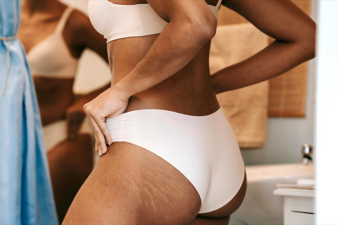 Ist „Second Skin“-Dessous eine echte Innovation – oder nur ein Marketing-Mythos?